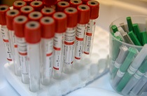 Главный инфекционист Приморья: Вакцинация населения сократит заболеваемость COVID-19 и повторные случаи заражения