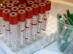 Более 400 случаев заболевания COVID-19 выявлено в Приморье за последние сутки